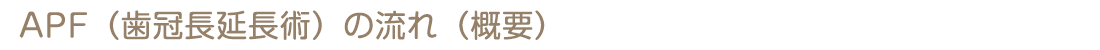 APF（歯冠長延長術）の流れ（概要）