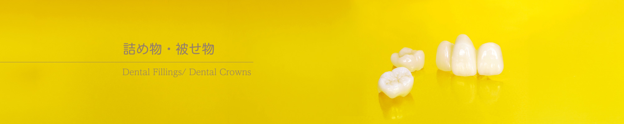 詰め物・被せ物