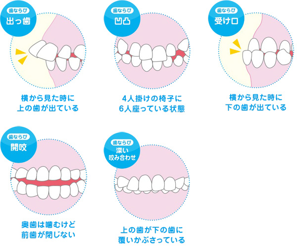 プレオルソ