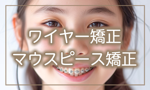 ワイヤー矯正マウスピース矯正